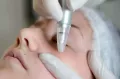 מהם טיפולי הפנים הטובים ביותר נגד הזדקנות?